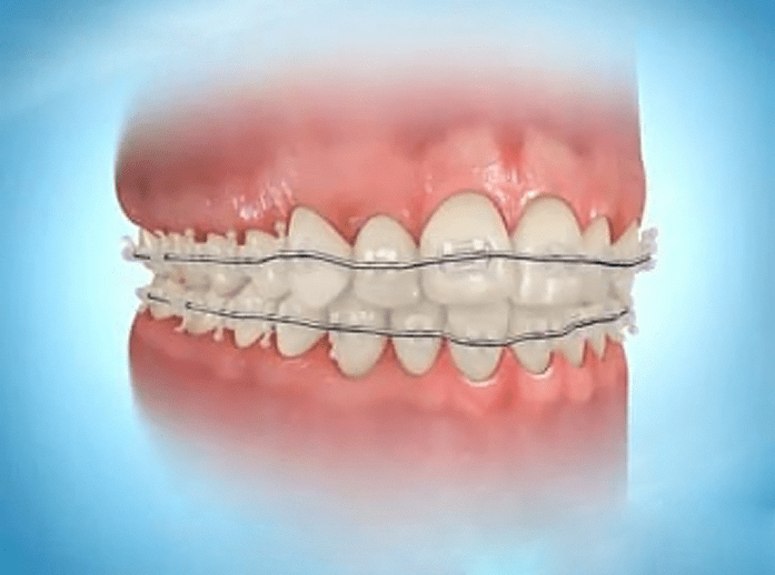 Totara Orthodontists